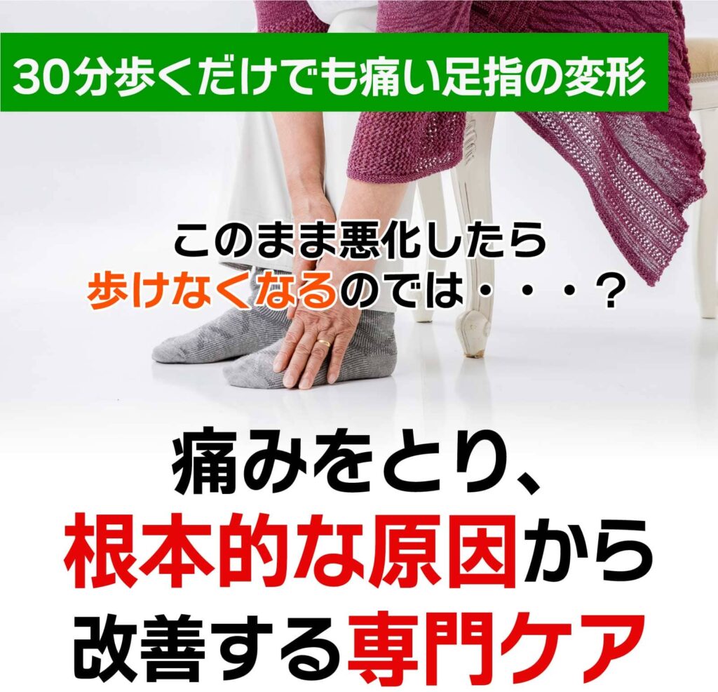 外反母趾専門整体